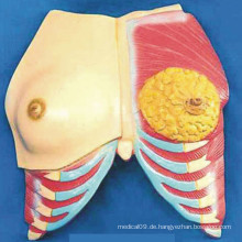 Menschliche Brust Anatomie Modell mit Muskel und Rippen (R150102)